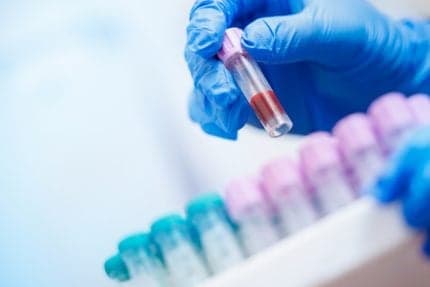 Blood Lab Medicare Fraudster Hid $23.9M, Gambled While Spending Millions